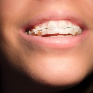 ortodoncia especializada