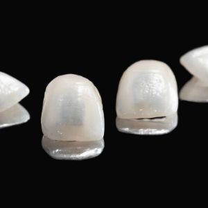 tratamientos dentales