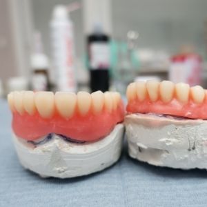 prótesis dental
