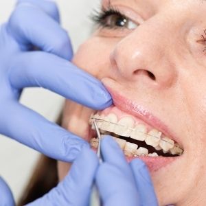 ortodoncia biológica